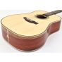 Takamine Custom Shop SG-CPD-AC1 Acoustic Guitar SN #6 sku number TAKSGCPDAC1 6